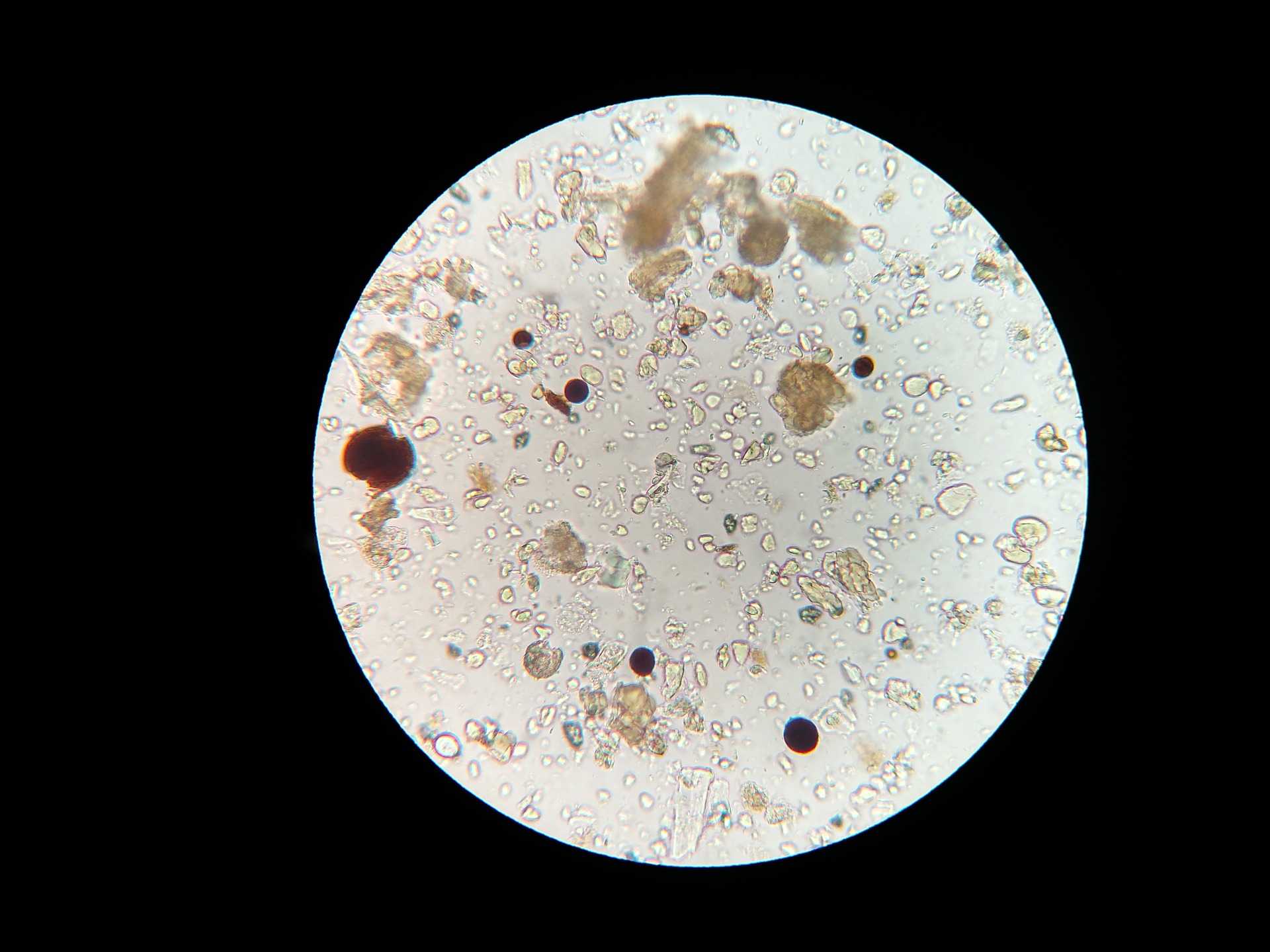 Infecciones polimicrobianas: microbios del suelo vistos desde un microscopio